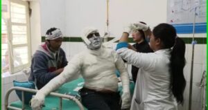 बड़ी खबर : SBI मैनेजर पर पेट्रोल डाल गार्ड ने लगाई आग