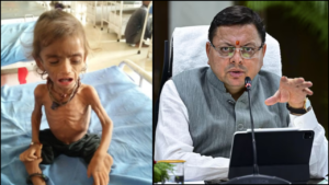 उत्तराखंड में चार सालों में ढाई गुना बढ़ी अति कुपोषित बच्चों की संख्या…जानिए आर्थिक सर्वेक्षण रिपोर्ट और कुपोषण खत्म करने की योजनाएं
