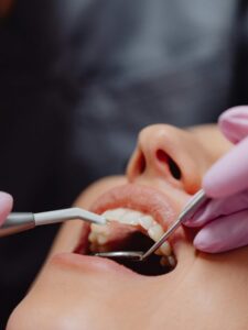 दांतों की कैविटी दूर करने के आसान घरेलू उपाय