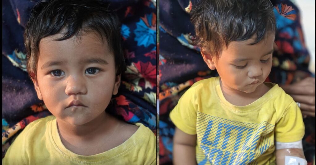 Delhi news: AIIMS के डॉक्टरों ने 14 महीने की बच्ची की जान बचाई, फूड पाइप में फंसा था मेटल का स्प्रिंग