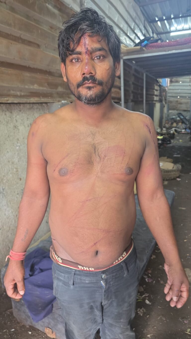 Navi Mumbai Crime News: भंगार चोरी से इनकार करने पर युवक की कथित पिटाई, चार आरोपियों पर मामला दर्ज