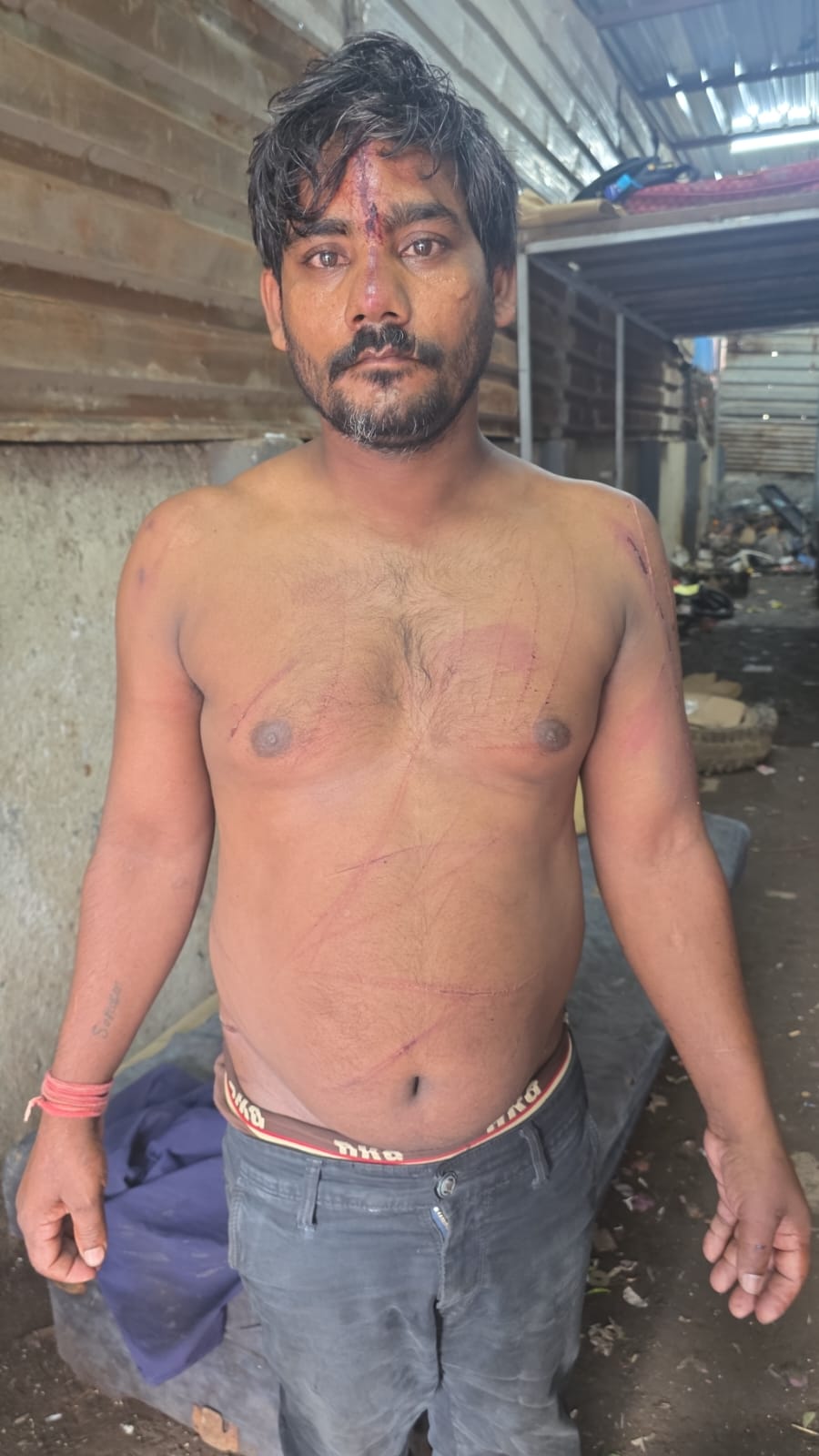 Navi Mumbai Crime News: तलोजा MIDC में युवक को कमरे में बंद कर बेरहमी से पीटा, चार आरोपियों पर मामला दर्ज