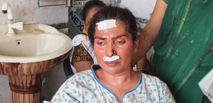 Unnao Crime: किन्नर के घर घुसे 3 बदमाश, जेवर-नकदी लूटकर फरार