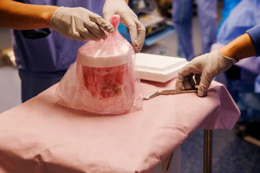 How Long Did the Pig Kidney Work?