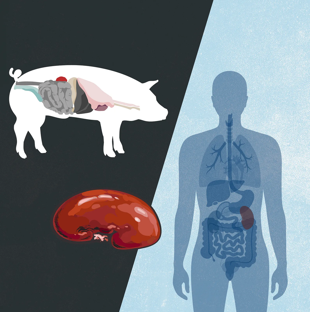 Is a Pig Kidney Transplant Safe?